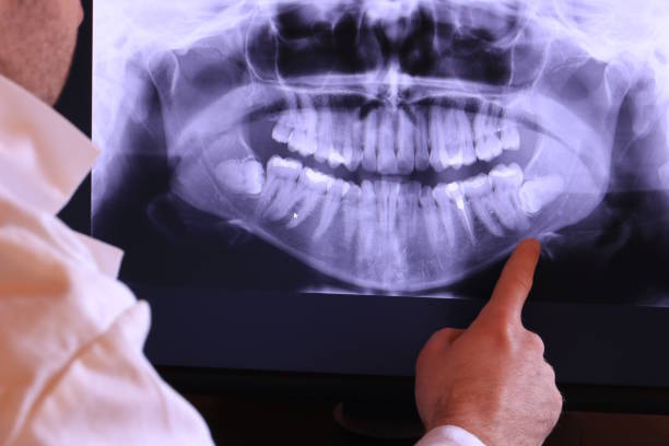 Best Emergency Tooth Extraction in New Providence, NJ