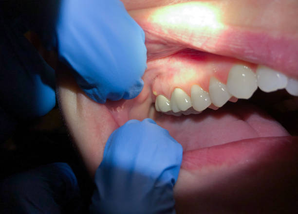 Best Emergency Tooth Extraction in New Providence, NJ