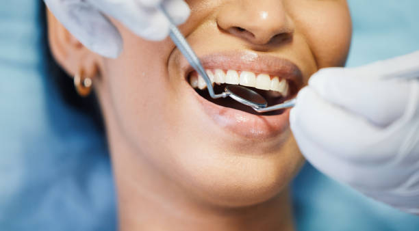 Best Emergency Wisdom Teeth Removal in New Providence, NJ